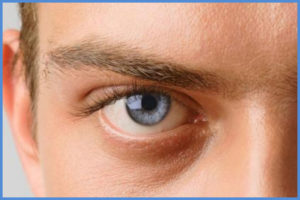 Soin contour des yeux pour hommes